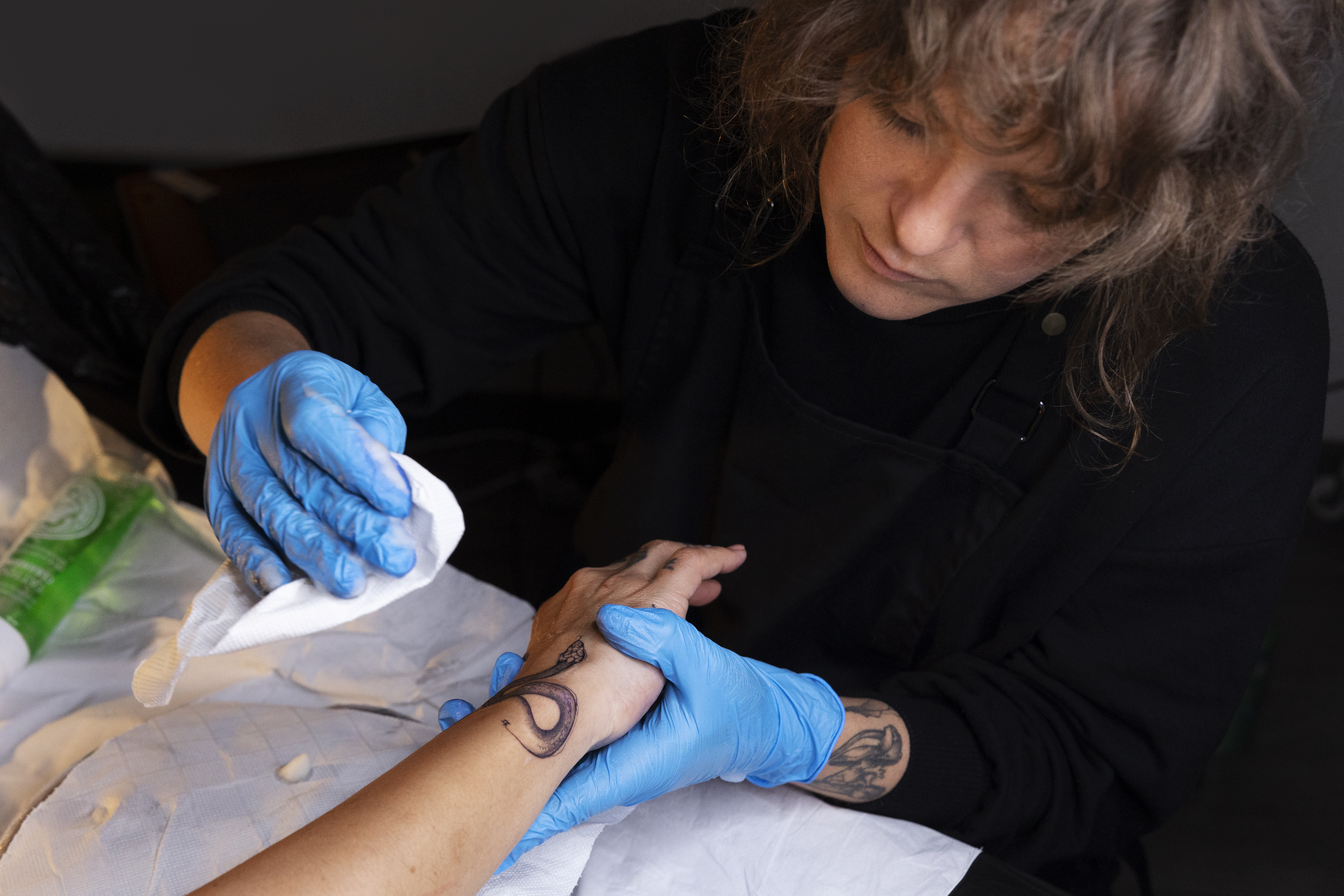 does laser tattoo removal leave scars?